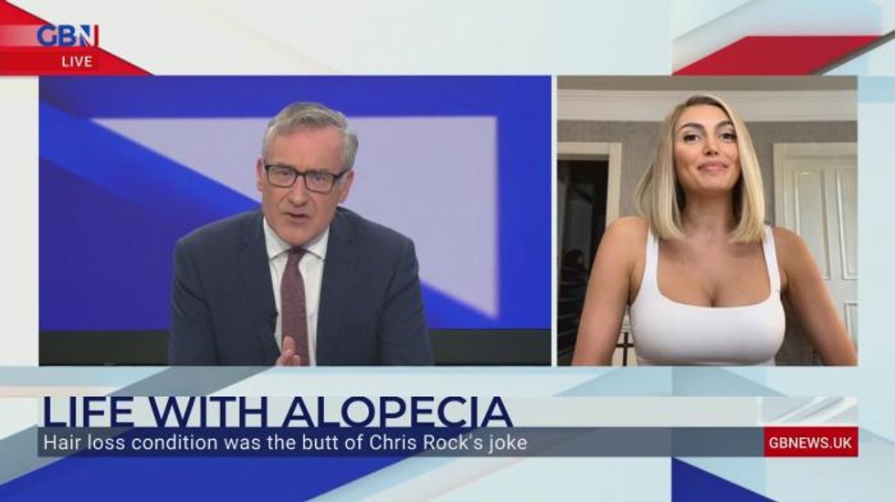 Moment brave alopecia sufferer removes wig live on air to highlight condition