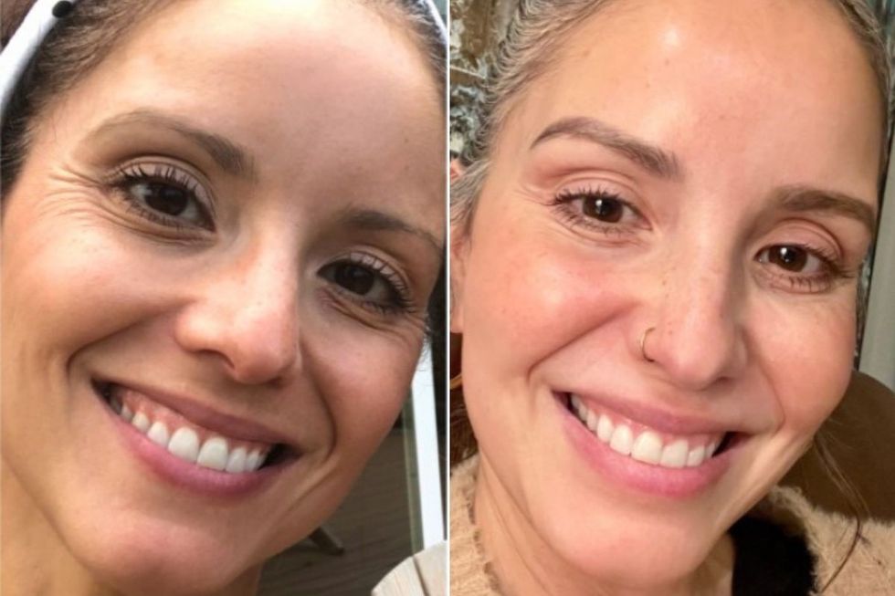 50-YEAR-OLD BEFORE AND AFTER