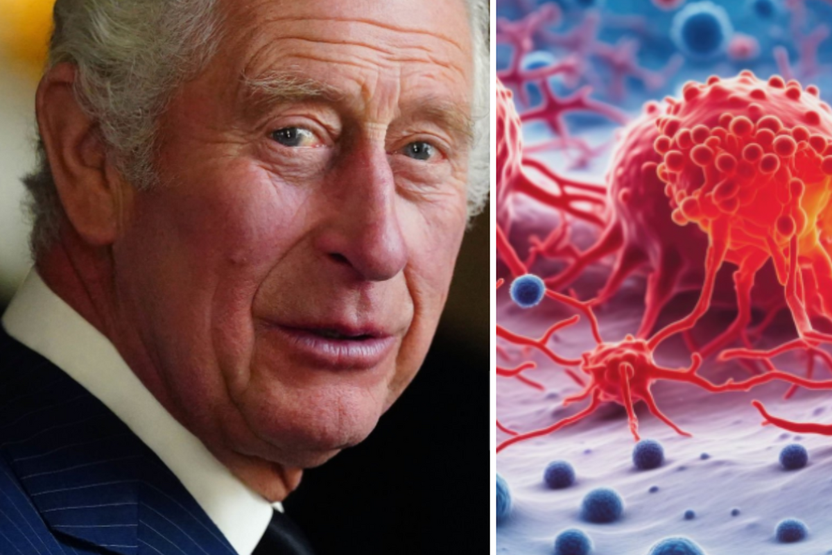 A composite image of King Charles on the left and a cancer cell on the right 