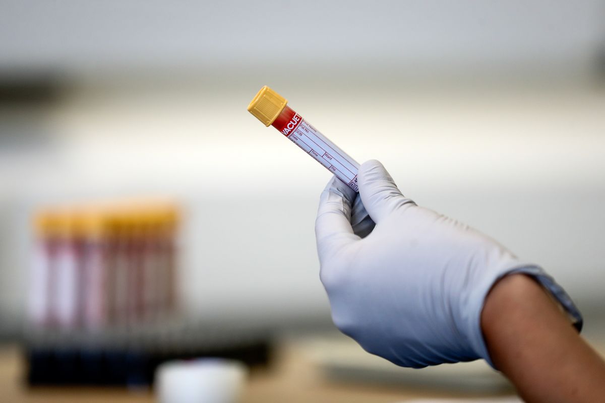 A doctor holding a blood test