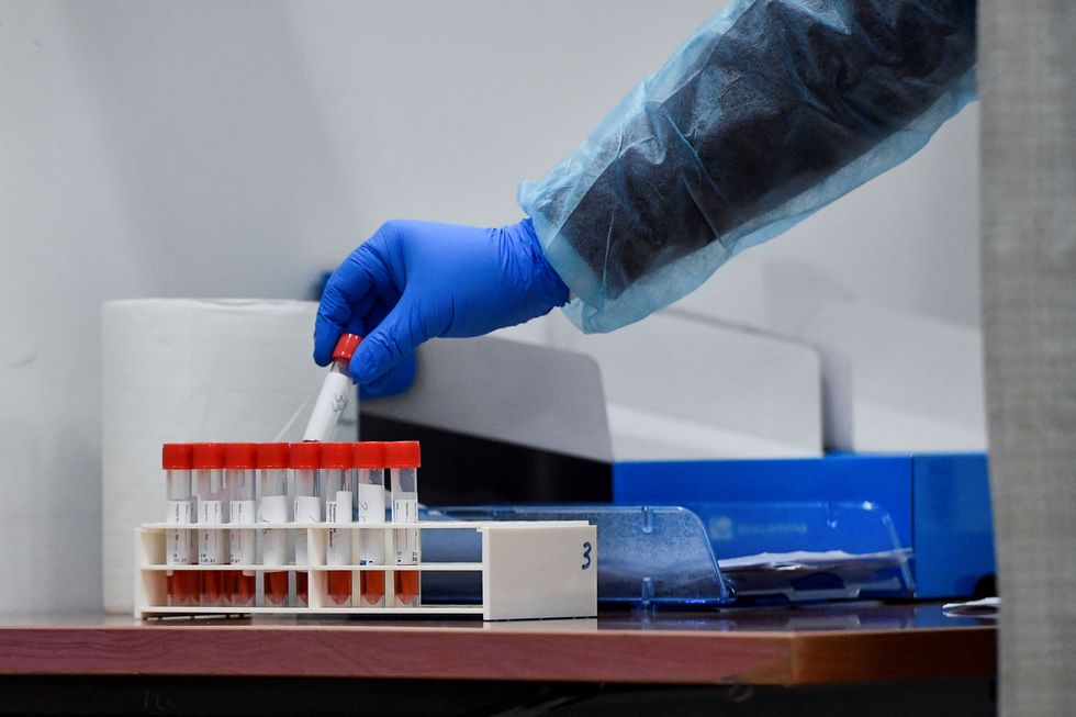 A healthcare worker places a vial with a swab of the coronavirus disease (COVID-19) test along with other vials, after Italy has ordered COVID-19 antigen swabs and virus sequencing for all travellers coming from China, where cases are surging, at the Malpensa Airport in Milan, Italy, December 29, 2022. REUTERS/Jennifer Lorenzini