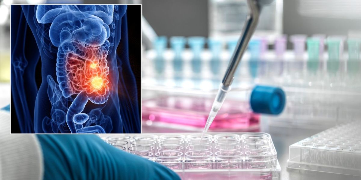 NextImg:Bowel disease: 'Holy grail' breakthrough as major cause of condition uncovered