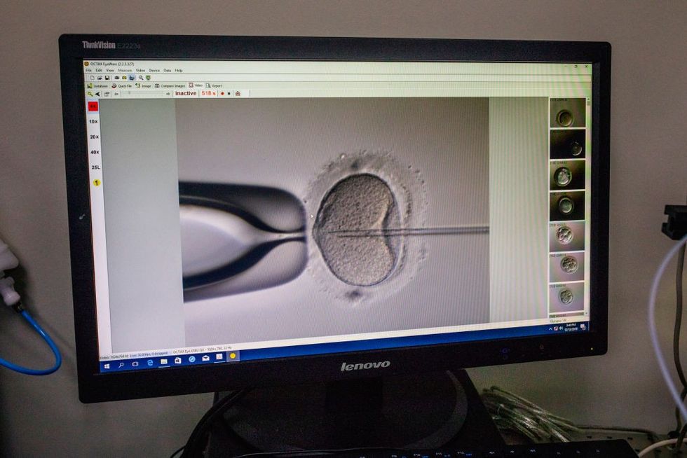 A screen showing the IVF process