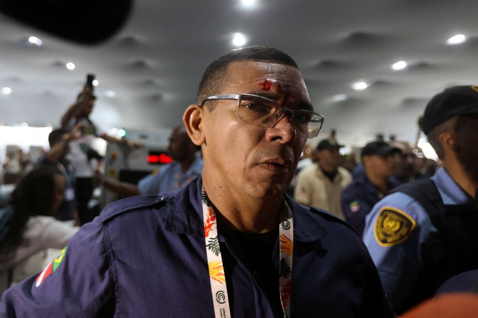A security guard with a cut above his eye