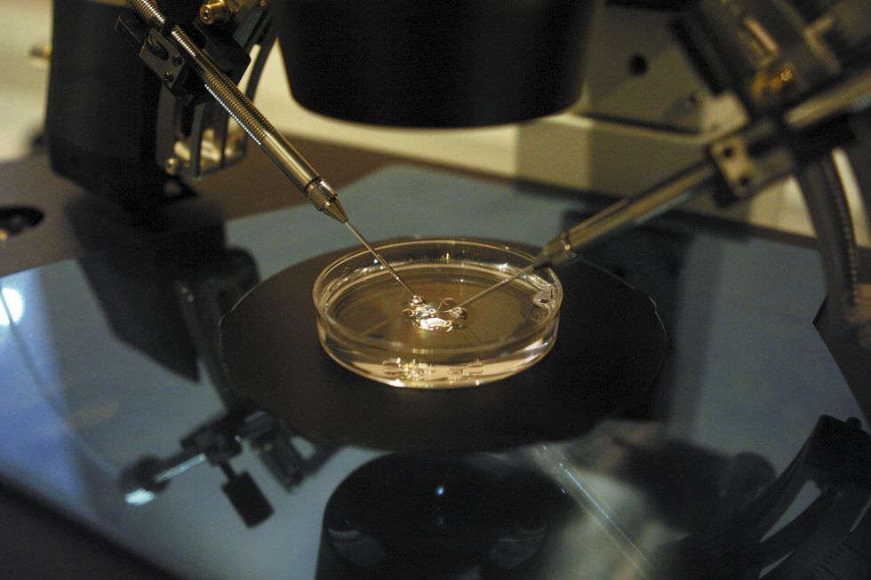 A sperm fertilizes an egg under a microscope using ICSI (Intra Cytoplasmic Sperm Injection) as part of IVF treatment