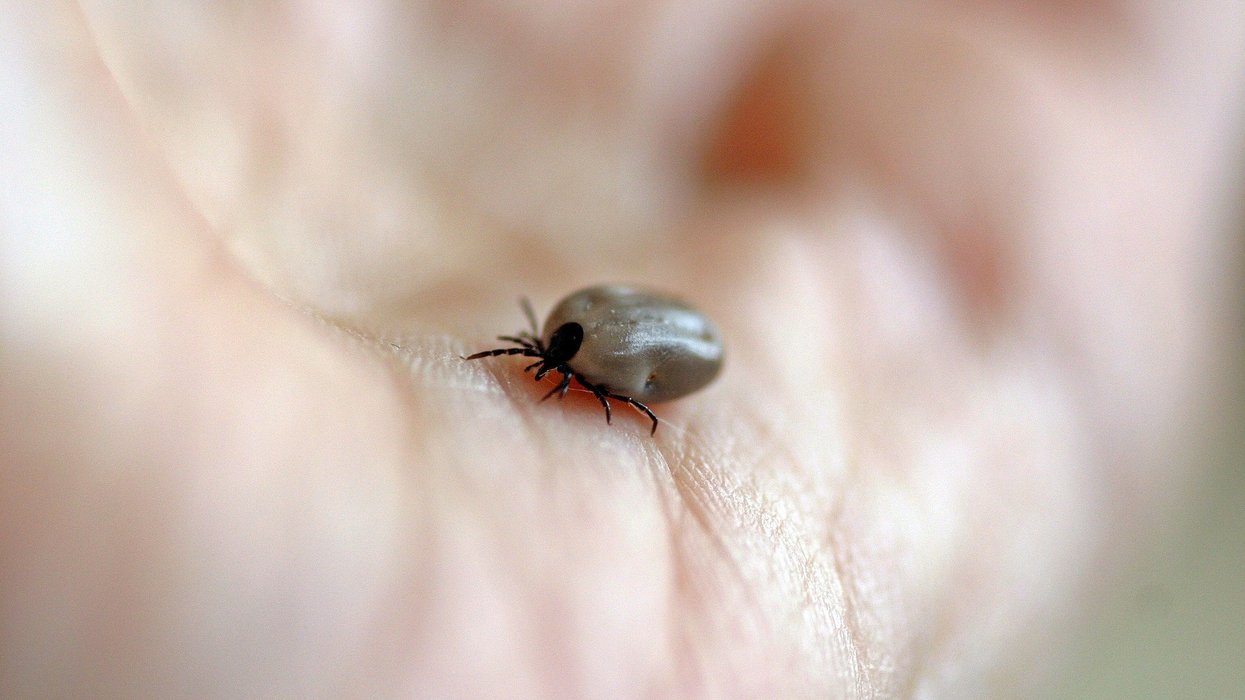 A tick on a human hand