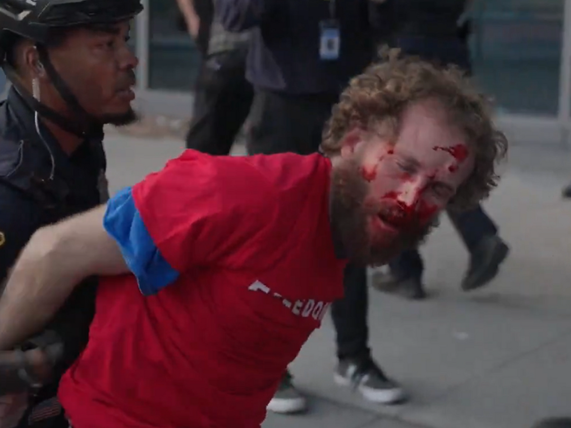 A Trump supporter with blood on his face