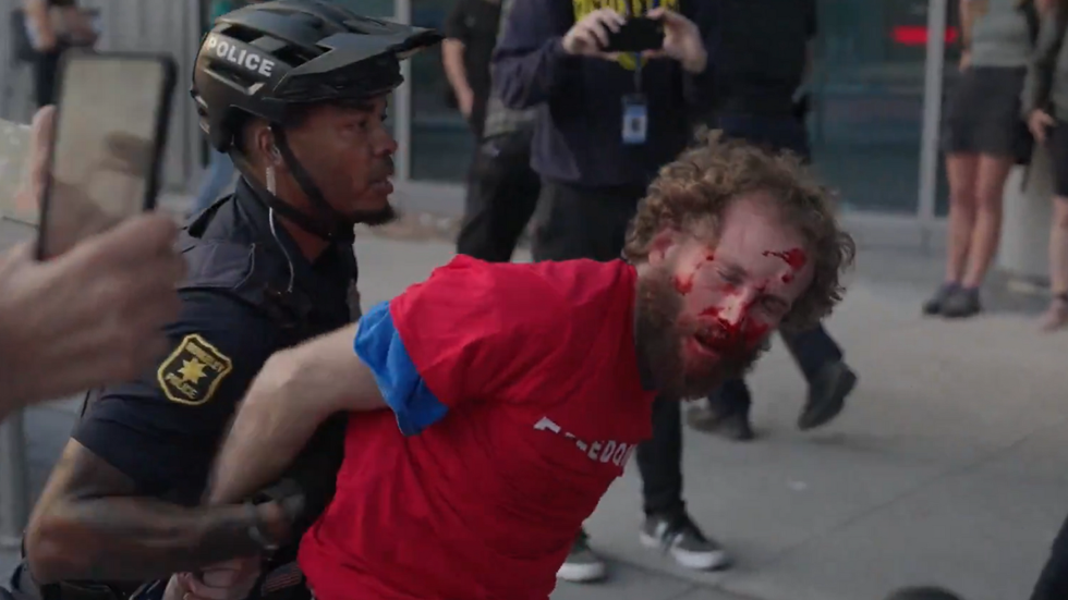 A Trump supporter with blood on his face
