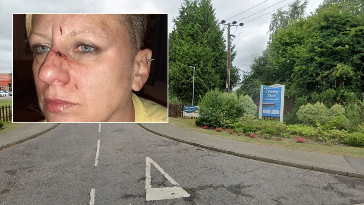 Dog 'mauls woman's face' in 'horrific' attack while on family holiday in Norfolk