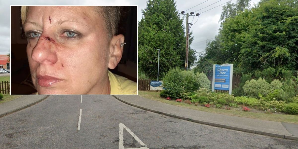 NextImg:Dog 'mauls woman's face' in 'horrific' attack while on family holiday in Norfolk