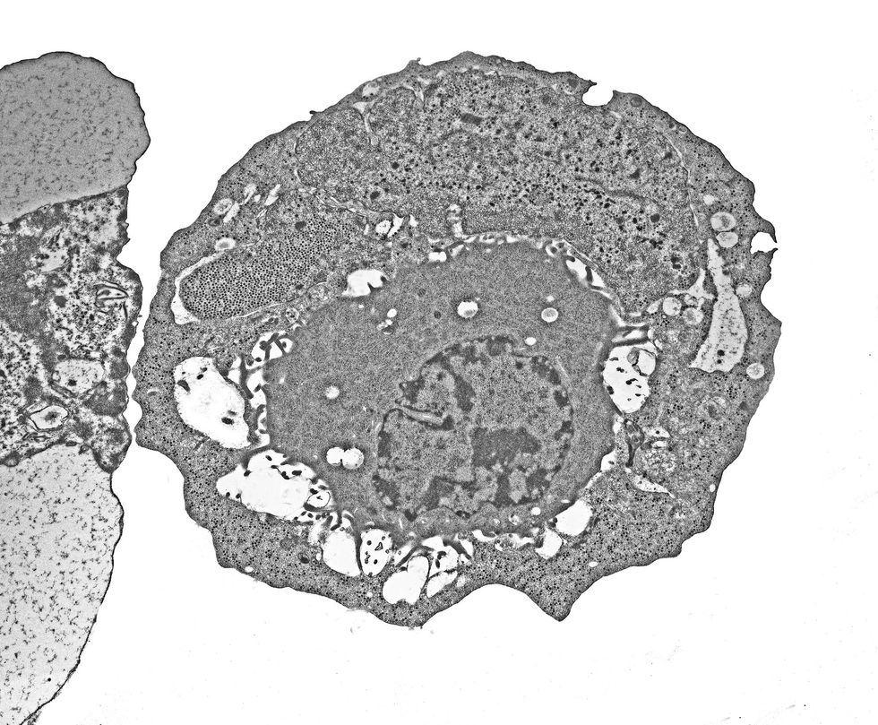 ADENOVIRUS MICROSCOPE
