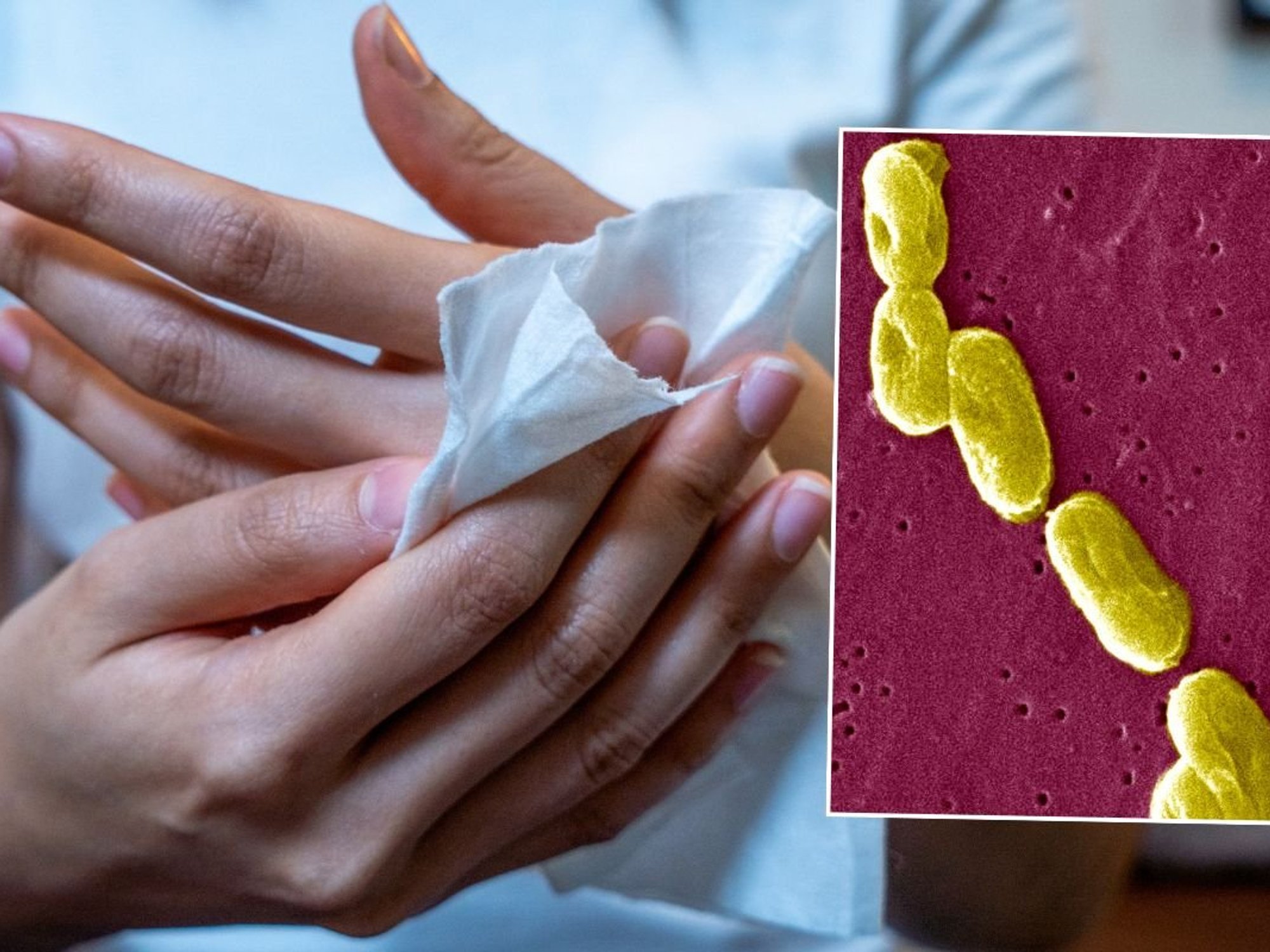 ALCOHOL WIPE AND BACTERIA UNDER MICROSCOPE