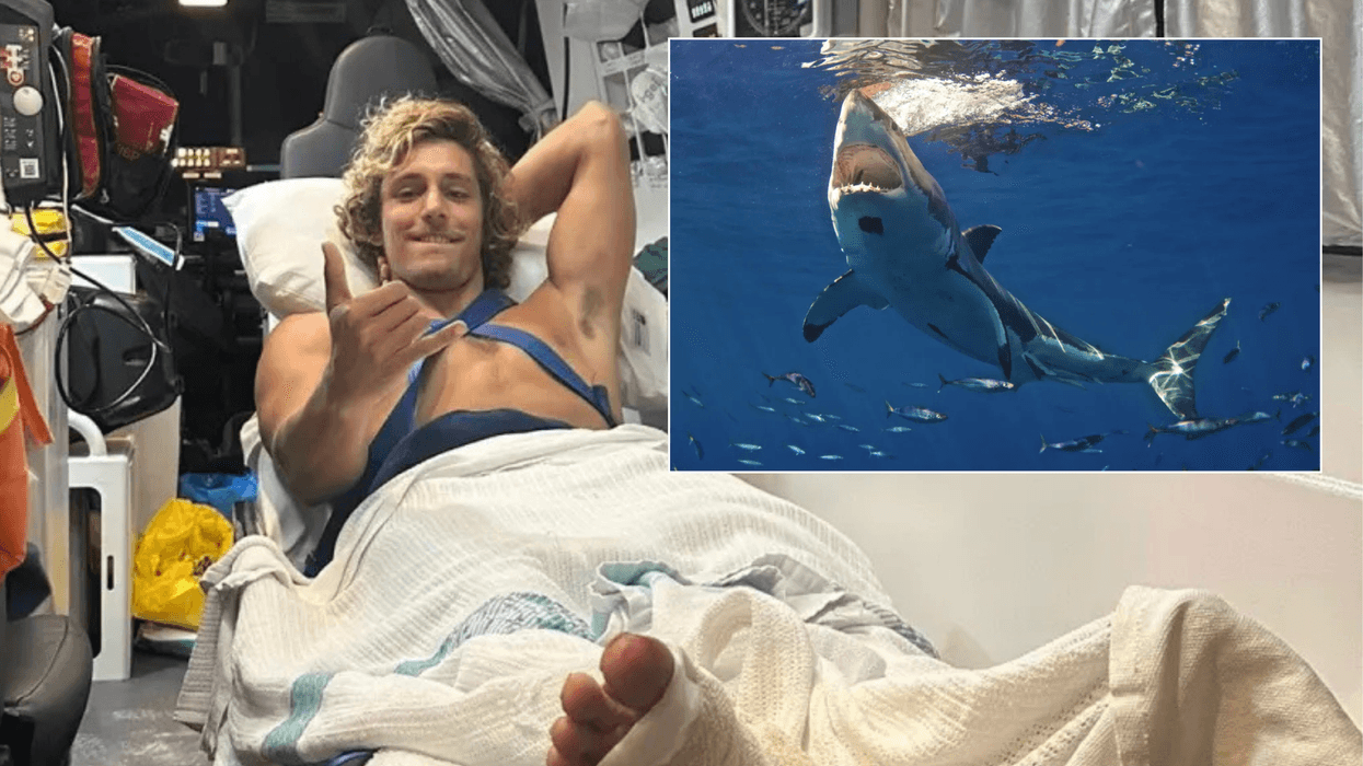 Alejo Santiñaque after shark attack