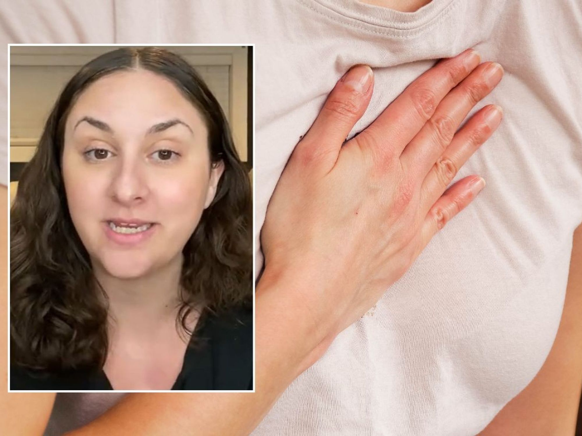 ALEX JADE AND CHEST PAIN PATIENT