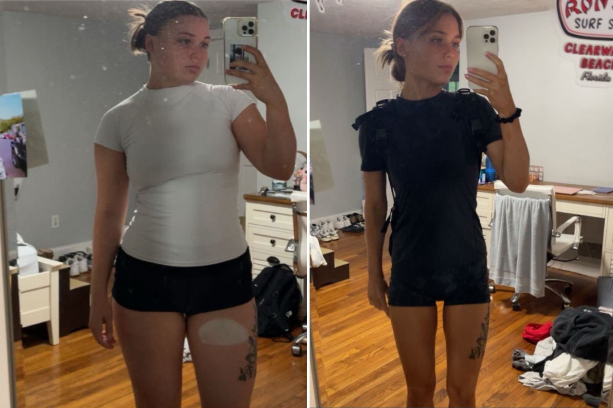 ALEXANDRA BEFORE AFTER SHOTS