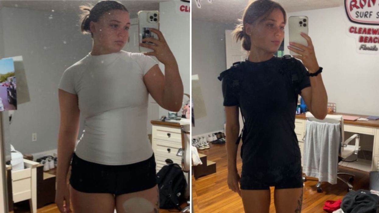 ALEXANDRA BEFORE AFTER SHOTS