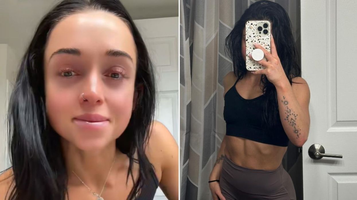 Alexis before and after