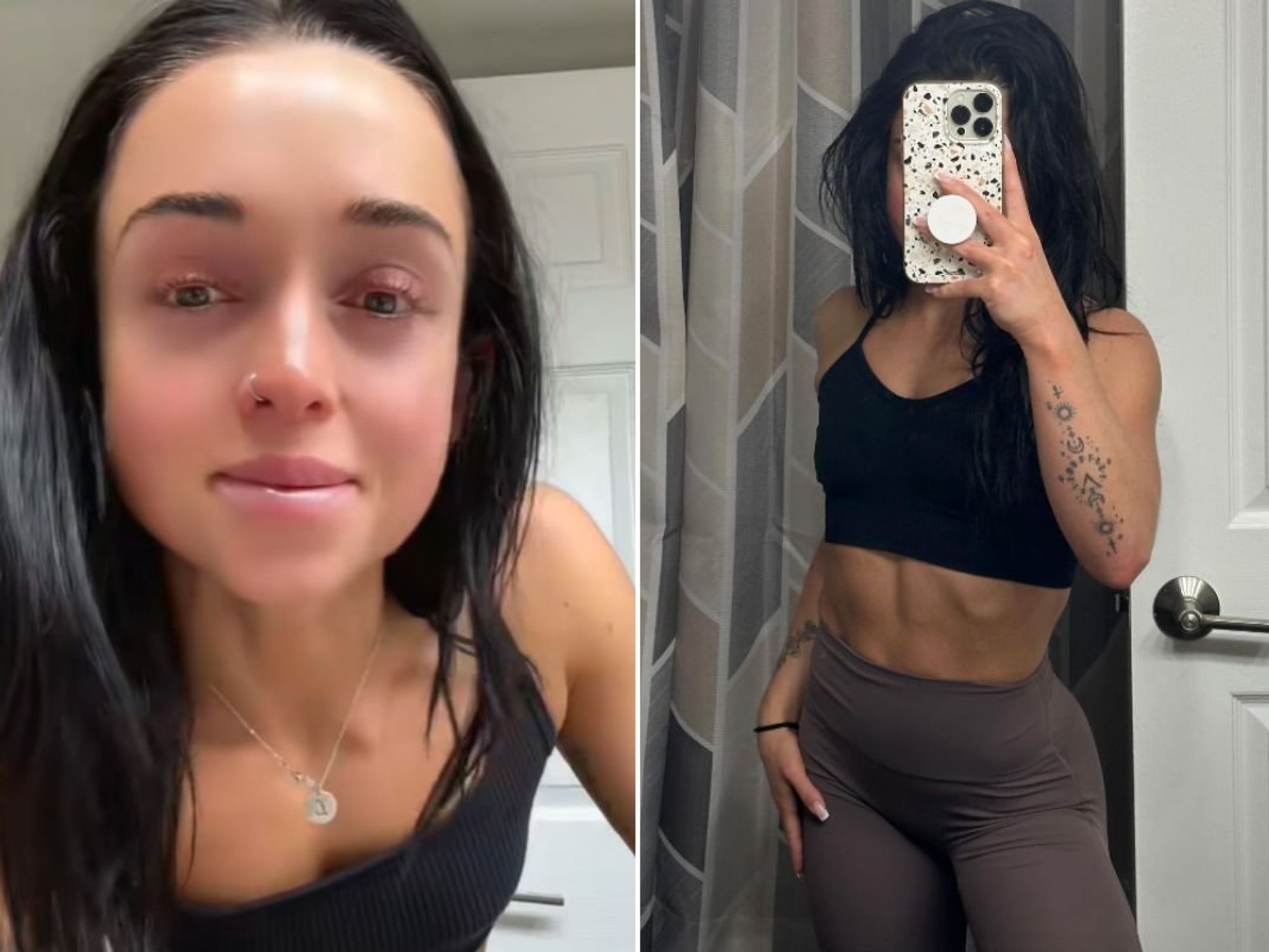 Alexis before and after