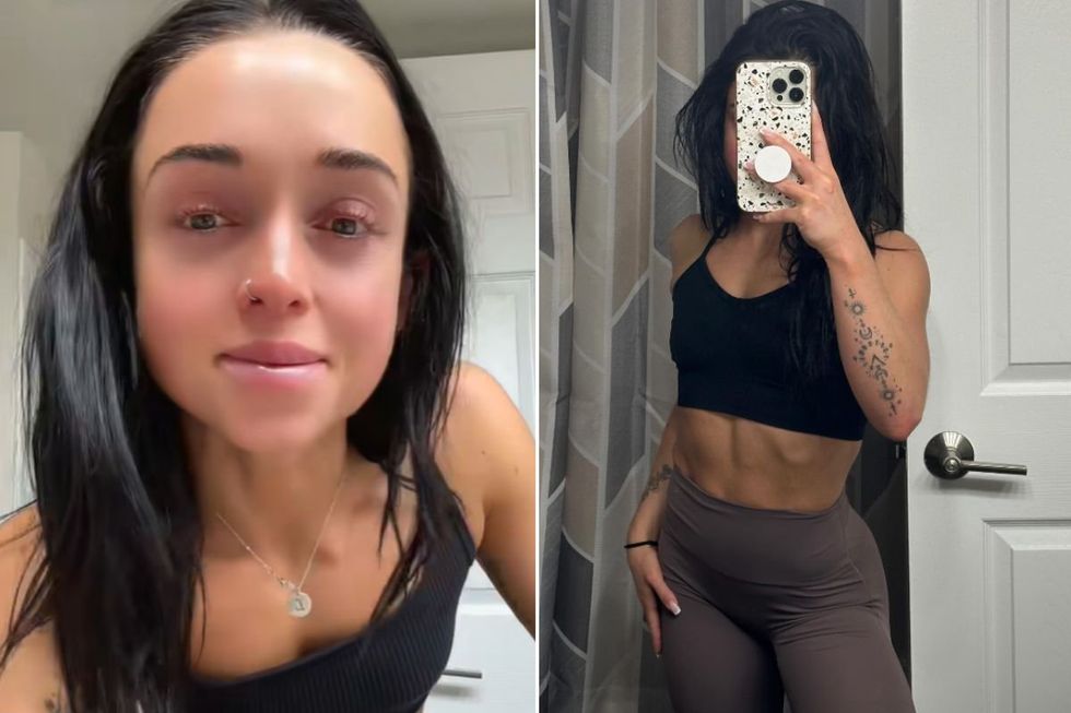 Alexis before and after