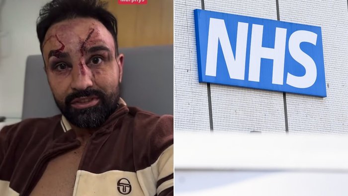 American bare-knuckle fighter Paulie Malignaggi has launched a scathing attack on the NHS, claiming medical staff who treated him following his October 2025 bout in Leeds were incompetent and caused lasting health problems