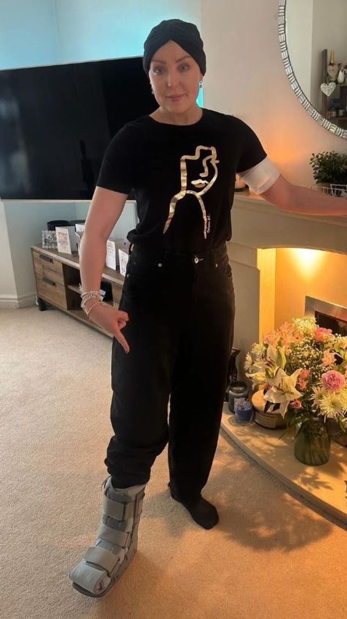 Amy Dowden broke her foot