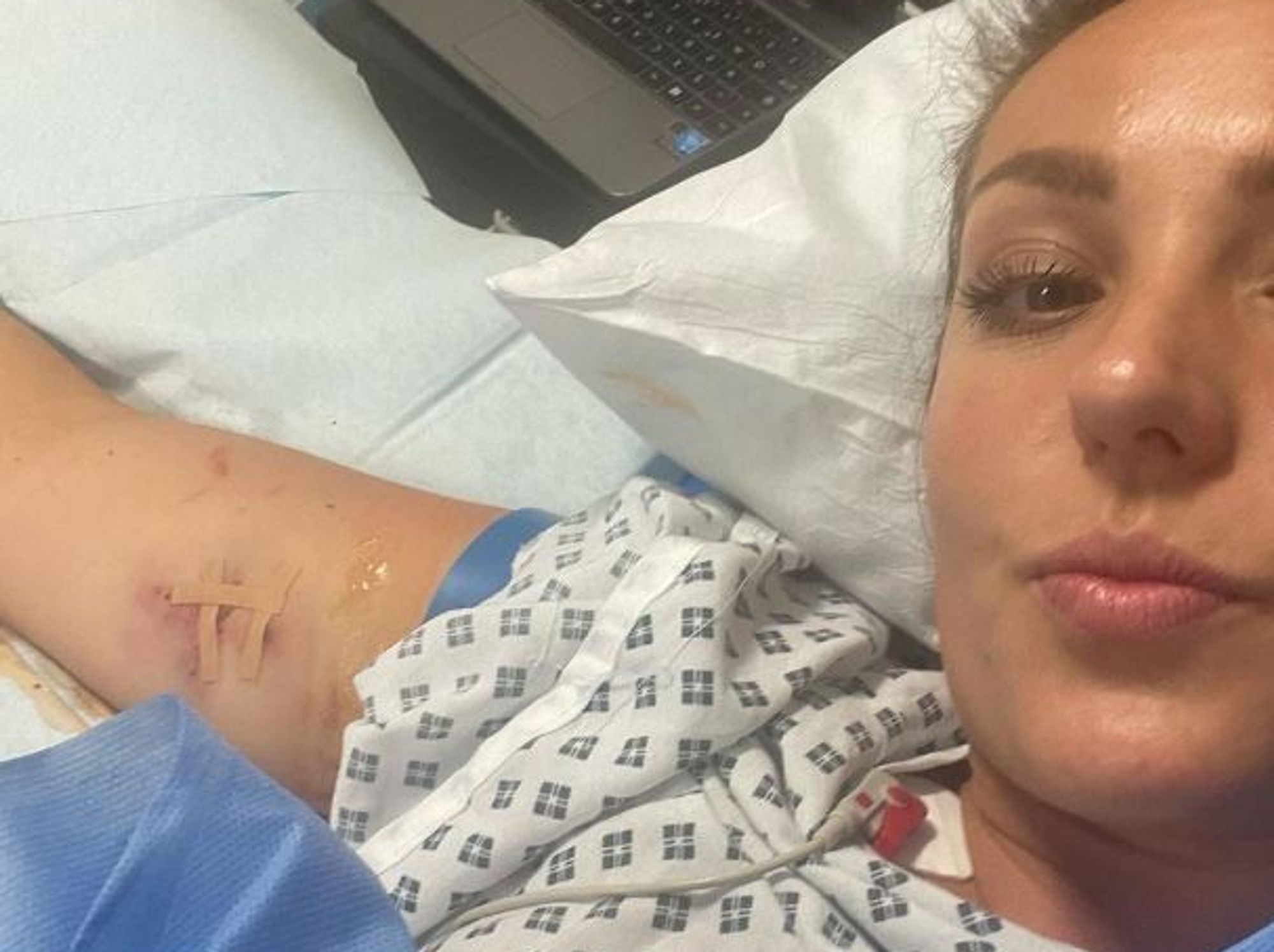 Amy Dowden shares snap from hospital bed