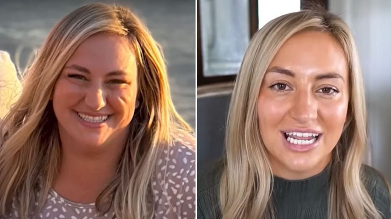 Amy Fritz before and after pictures