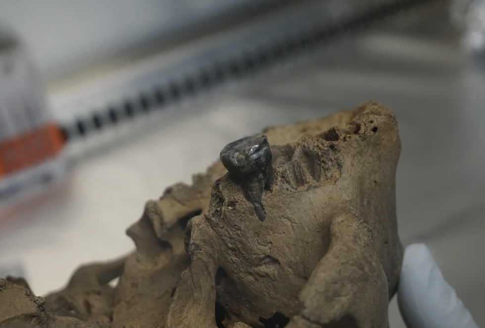 An ancient tooth