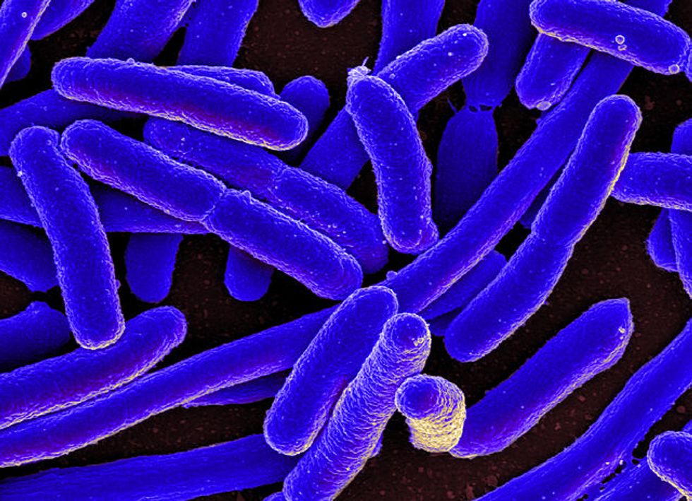 An electron micrograph of E.coli