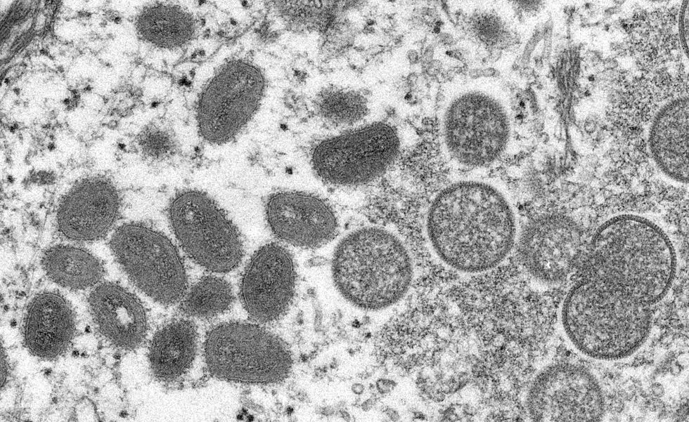 An electron microscopic (EM) image shows mature, oval-shaped monkeypox virus particles.