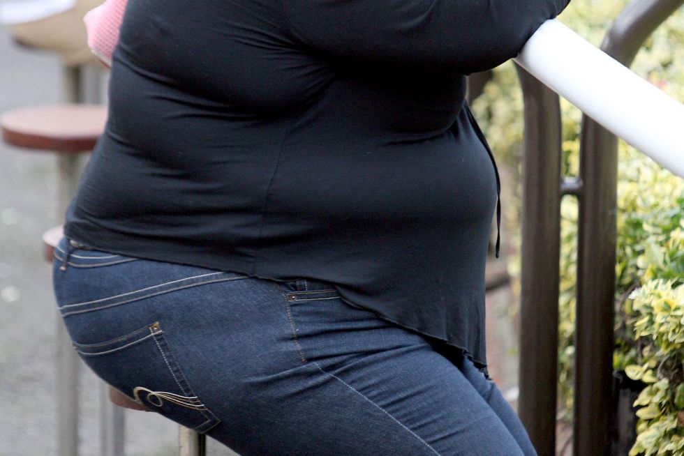 An obese person in England