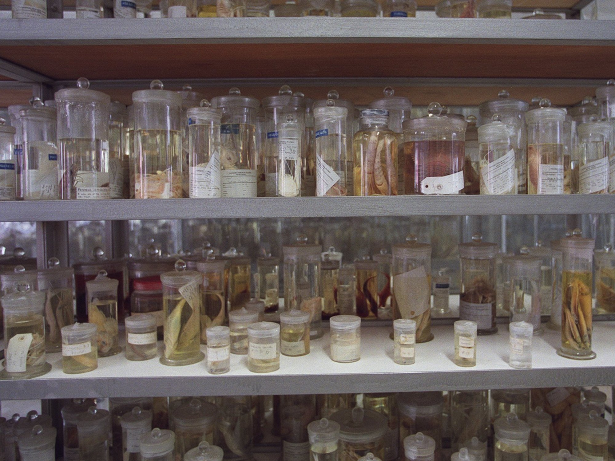 Anatomy jars
