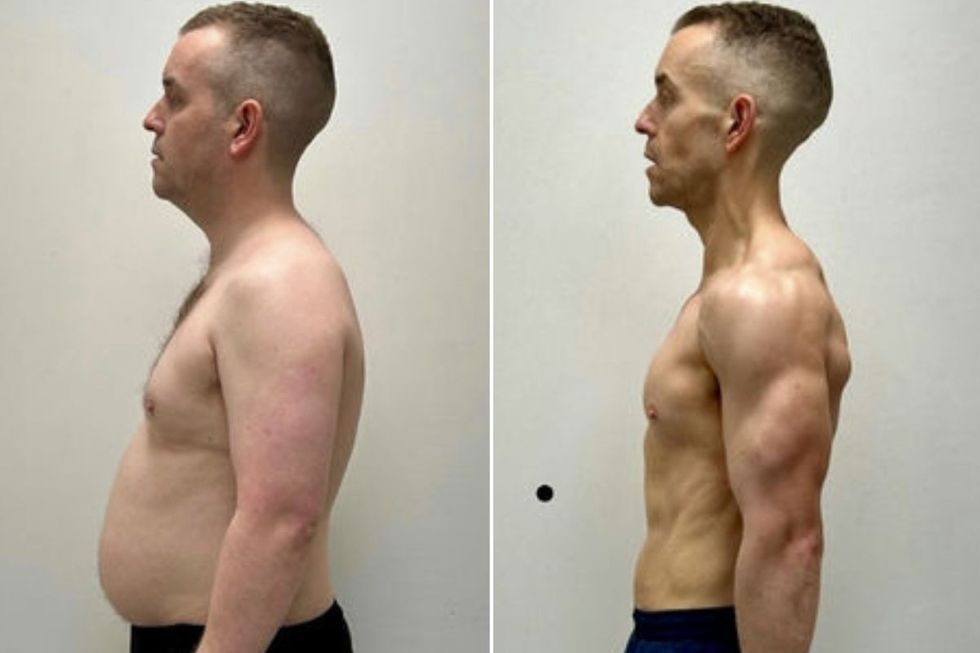 Andrew Kelly before and after