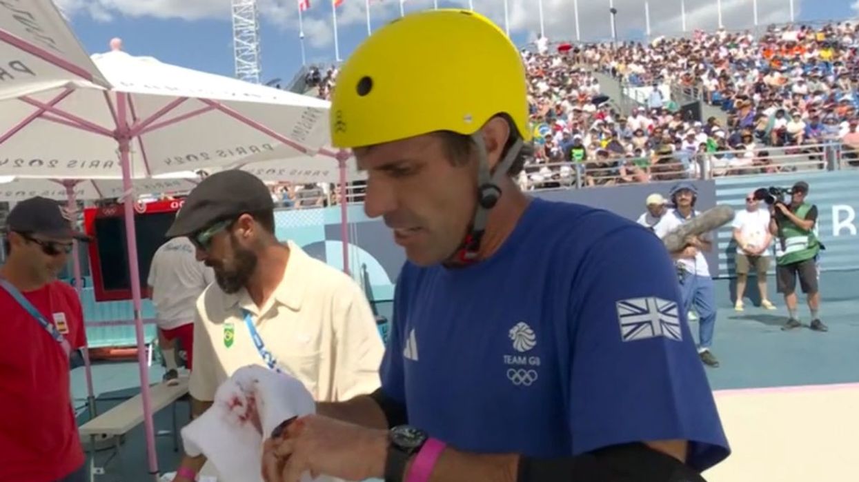 Andy MacDonald suffered a cut during his second run