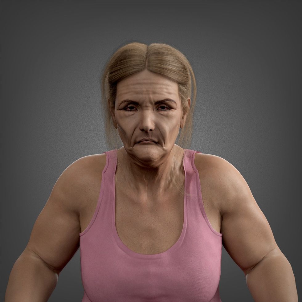 Anna with swollen eyes