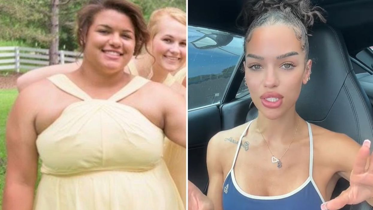 Annabella before and after