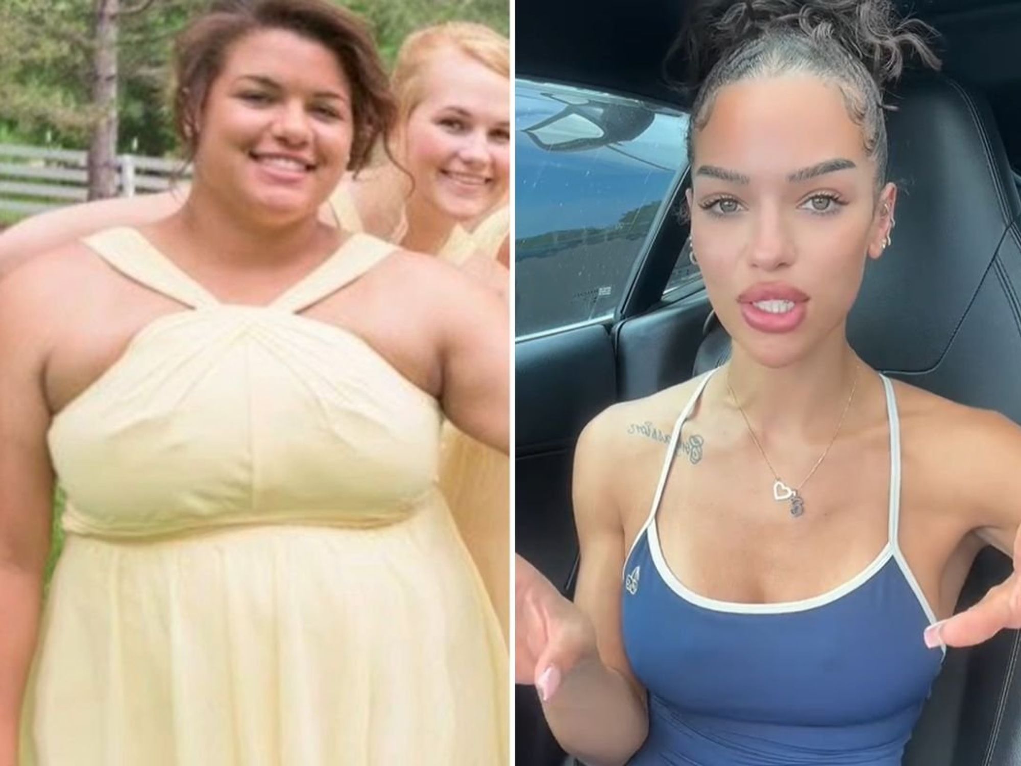 Annabella before and after