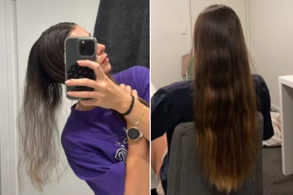 Annabelle Ronnfeldt shared images of her hair regrowth