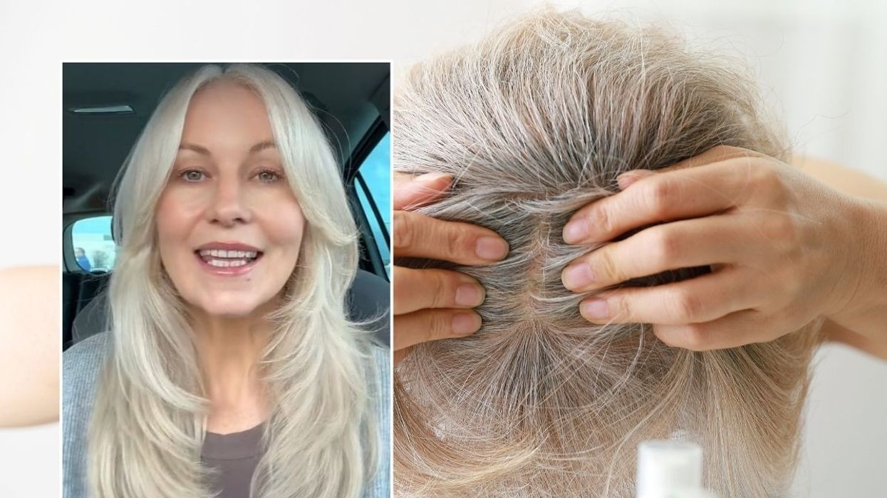 annamaria and scalp check