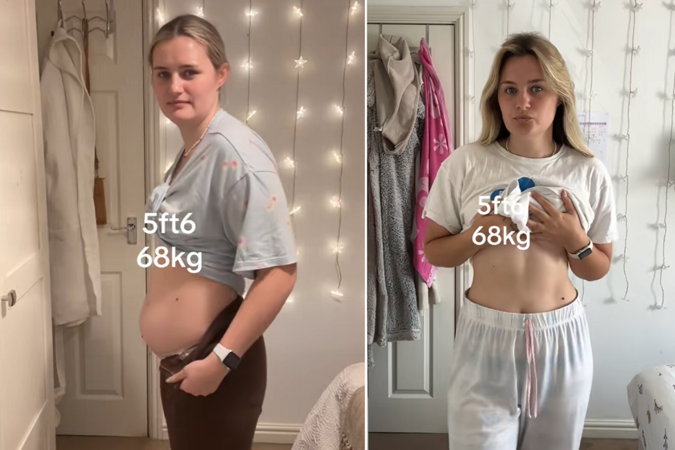 Annie shared before and after pictures from her 'self-improvement journey'