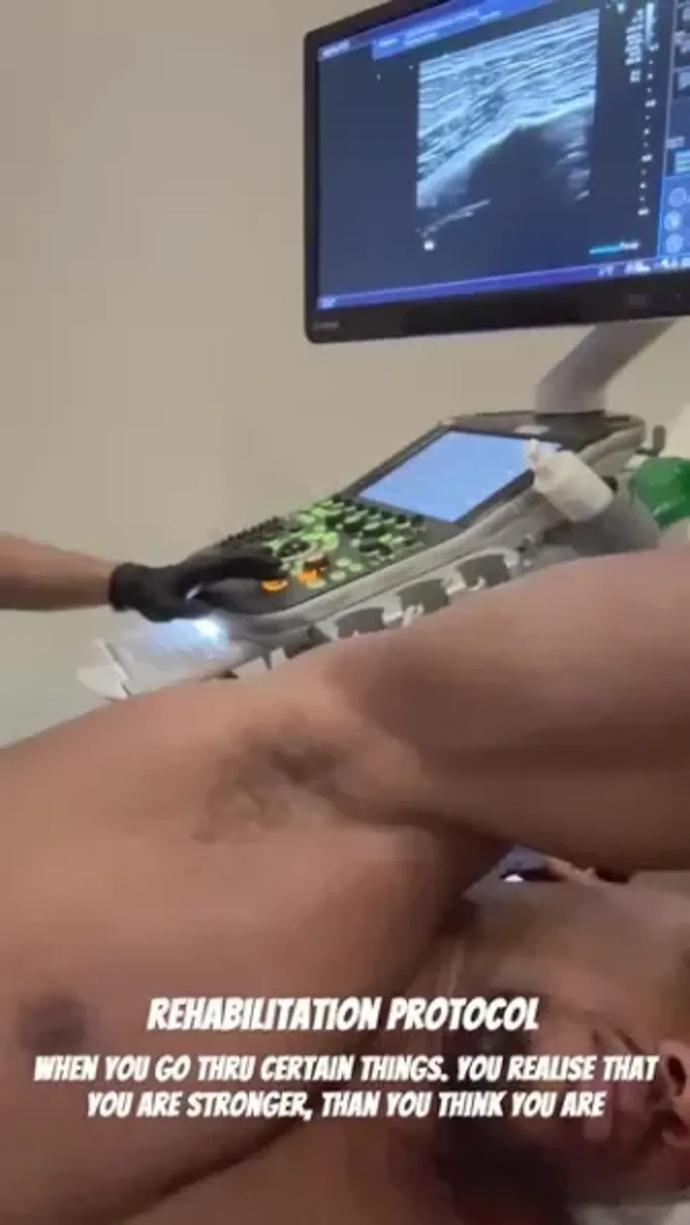 Anthony Joshua took to Snapchat to update his fans