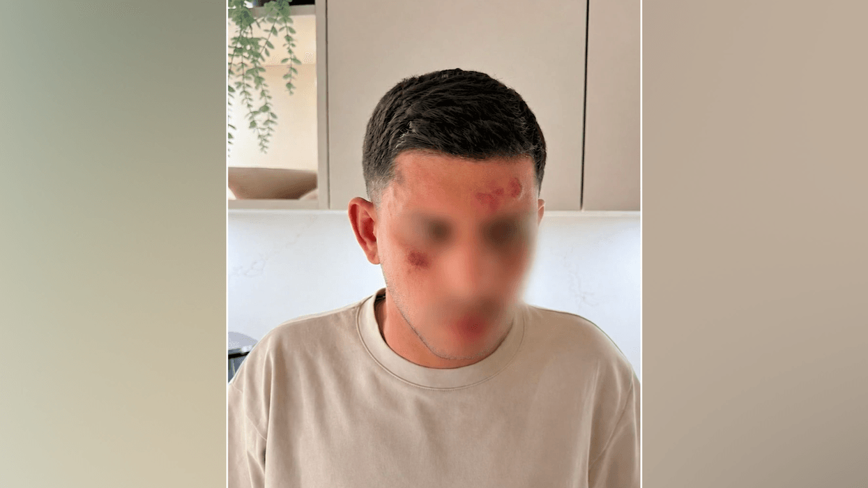 Antisemitic attack victim