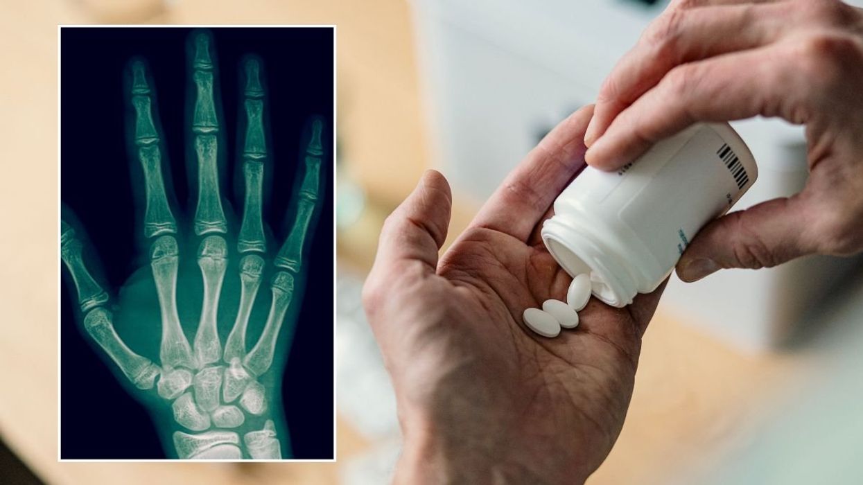 GP breaks down 'early side effects' of statins and the 'most bothersome' longer-term