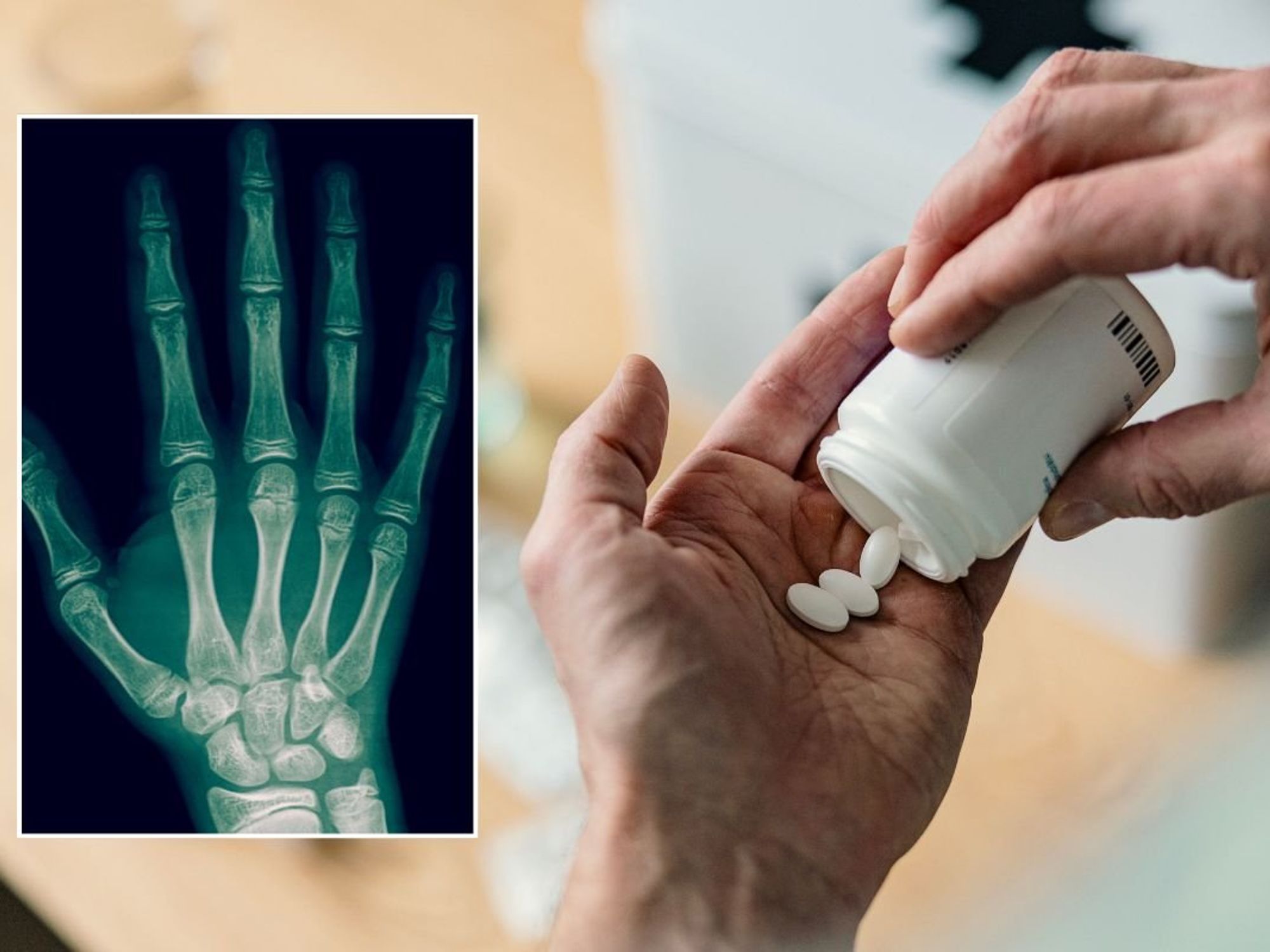 GP breaks down 'early side effects' of statins and the 'most bothersome' longer-term