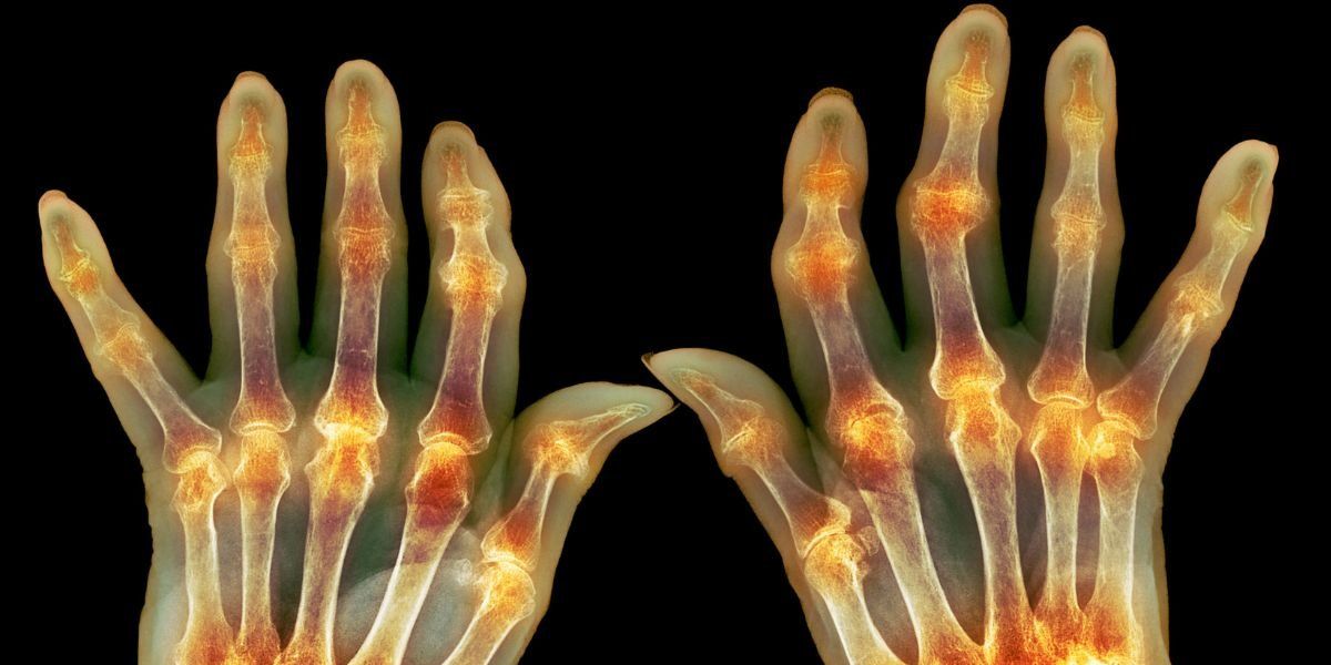 ‘The single best thing you can do’ for joint pain, according to experts ‘The single best thing you can do’ for joint pain, according to experts