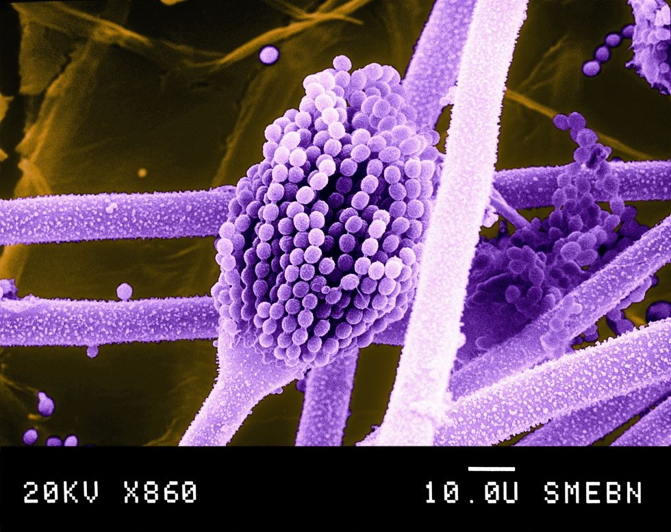 Aspergillus flavus