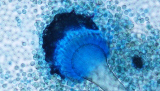 Aspergillus fumigatus under a microscope