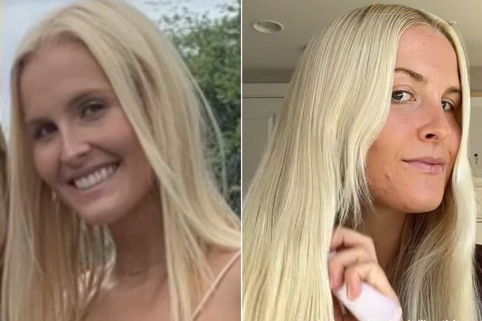 audrey before and after