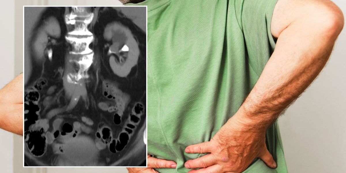 Nearly 40% of stage 4 patients experience the same pain, report reveals Nearly 40% of stage 4 patients experience the same pain, report reveals