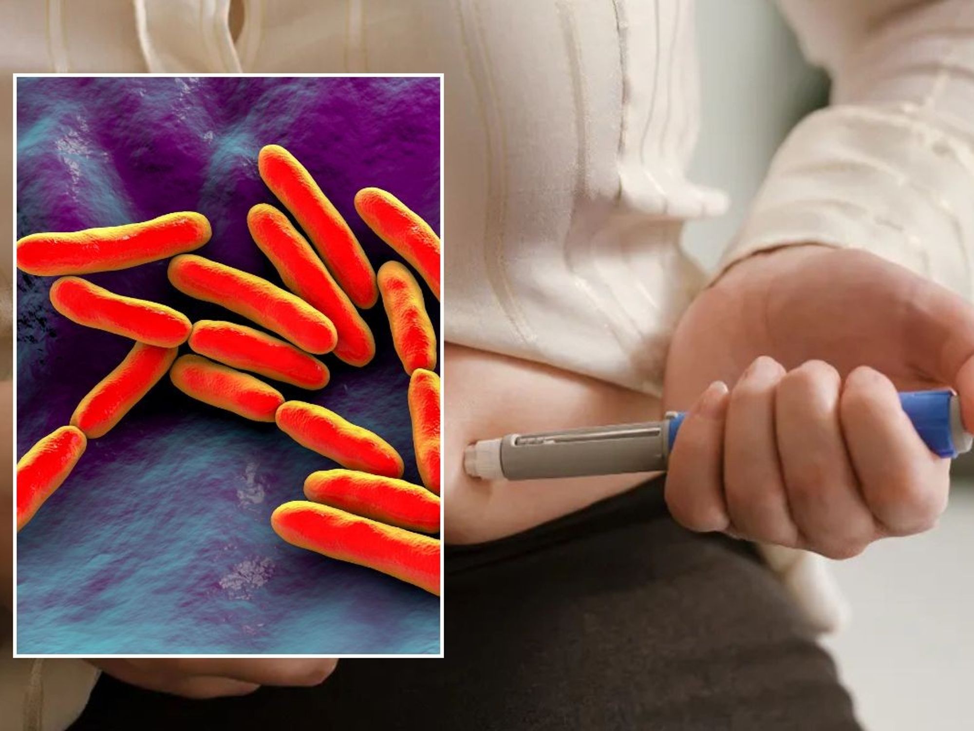 BACTERIA IN GUT ILLUSTRATION